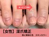 【お試し】女性●深爪で爪色が気になる方/肌に馴染む色付深爪矯正￥23100→