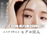 【美人の象徴◆若見えまんまるおでこ】額ヒアルリッチ注入おでこ集中ケア