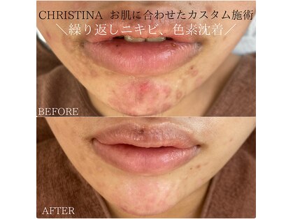 リレマ(rirema)の写真