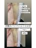 4【半身(上or下)選択ピーチ脂肪☆】キャビゼロ半身付!引き締め90分痩身¥15000