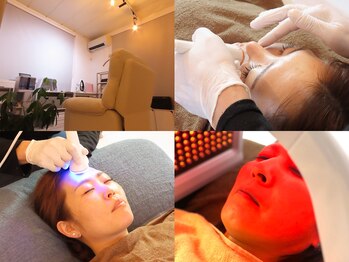 キララフェイシャル(kirara facial)