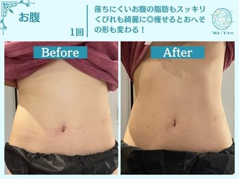 フローフシ∞/【痩身/たるみ】ダイエット革命