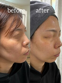 リノ ポノ(Lino Pono)/脅威のレッドショット