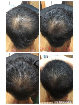 ミーフォレスト(Mi Forest)/