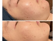 お気軽ビューティエーヴィヒ(Ewig)の雰囲気（ オーナー施術のエステも◎ハーブピーリングがオススメ★）