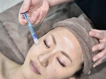 ドリームストリーム(Dream Stream)/【ヒト幹細胞×ピーリング】