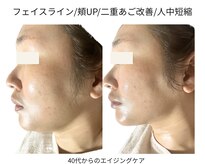 グロウ バイ フェイシャルデザイン アンド アイ(GROW)
