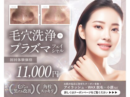 ジュエルボンド(Jewel Bond)の写真