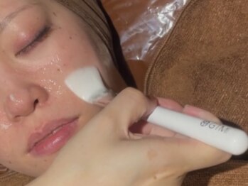 ヨソイ(yosoy)の写真/ニキビケア・シミしわ改善にも◎お悩みに合わせた施術で、お顔のたるみを改善！美肌に導きます♪