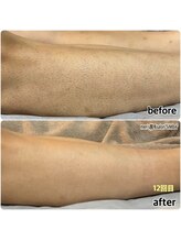 シンバ 倉敷店(SIMBA)/