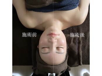 ラースパ アザブ(La SPA azabu)/小顔before→after