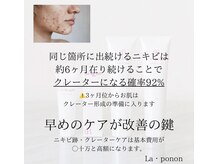ラポノンプラス(La ponon+)の雰囲気（ニキビ・毛穴ケア専門アイテム取扱ございます。）