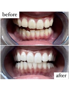 ライトケアサロン 渋谷店(Light Care Salon)/セルフホワイトニング