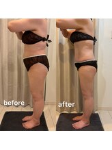 レミュービューティー(Remieux beauty)/before/after