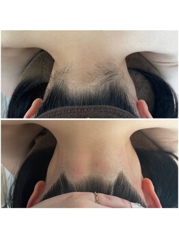 ミース 北九州店/うなじ●ビフォーアフター