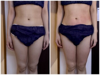 イーリバイブ/iNVYDOM MAX