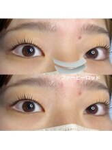 ジョリー(Jolie)/