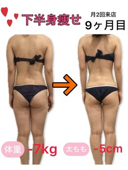 アフリオーラ はなみずき店(affriolant)/ビフォーアフター