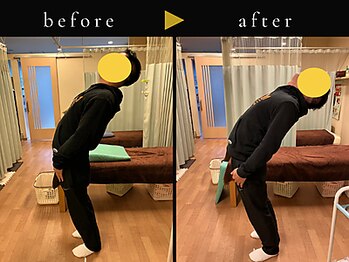 杉本接骨鍼灸院/五○肩といわれたが1回で