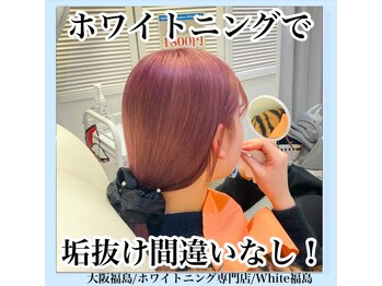 ホワイトニングサロン ホワイト(WHITE)/セルフホワイトニング/大阪/福島