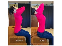 腰ラボ(腰Labo)/施術後の変化