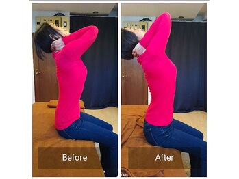 腰ラボ(腰Labo)/施術後の変化