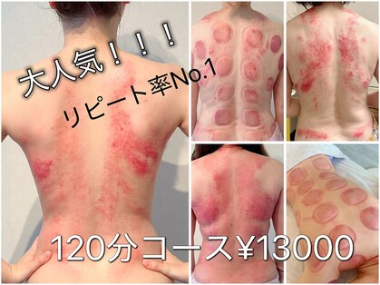 ビレイ(Birei)の写真