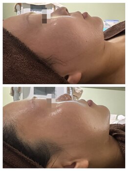 アトリエール(Ateliere)/ブライダルや大切な日のために☆