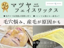 ソーヴ(SOLVE)の雰囲気（毛穴の黒ずみ・産毛脱毛や汚れオフ＆美肌も叶って感動の仕上り◎）