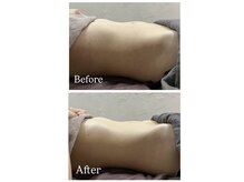 腸から身体の根本改善・美しさを目指します