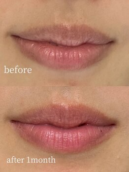 ホワイトニングショップ 奈良生駒店/唇のくすみ/リップケア