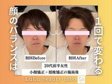 ルルラボ(LuLu beauty labo)/歪みが変わると顔が変わる