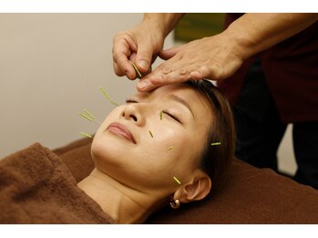 とまり木鍼灸整骨院 北青山院/丁寧な美容鍼施術です