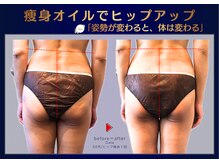 リラクゼーションサロン グレンツェン(Glanzen)の雰囲気（【痩身オイル】たるんだお尻をヒップアップ！肌も整い美尻へ変身）