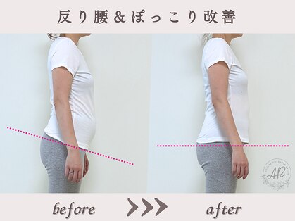 エーアール(AR)の写真