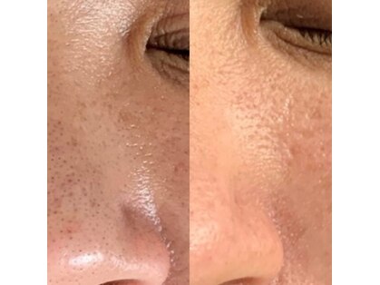 エースビューティー(Ace.Beauty)の写真