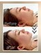 エトア 中目黒(ETOA)の写真/【大人のための立体小顔リフト】韓国発の最新オンダリフトで一人一人のお悩みをオーダーメイドで解消◎
