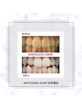 ホワイトニングショップ 日本橋店/【理想の白さへ】
