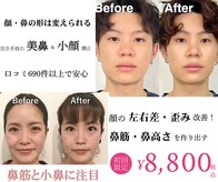 ラプリナーゼ 吉祥寺店(Raplit Nase)