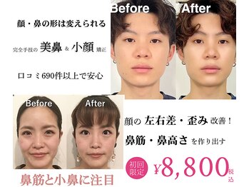 ラプリナーゼ 吉祥寺店(Raplit Nase)