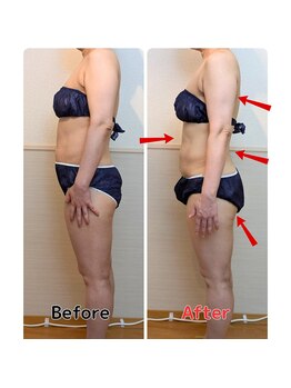 ヨサパーク フルード 栃木(YOSA PARK flod)/お客様の成果(引き締め1ヶ月半)