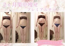 上野エステサロン レア(Lea)