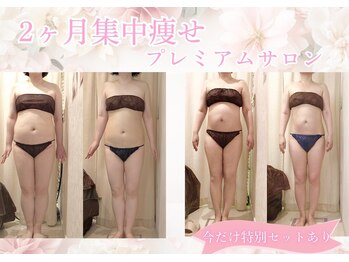 上野エステサロン レア(Lea)