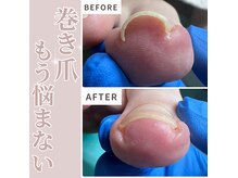 巻き爪補正店 那覇店