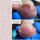 巻き爪補正店 那覇店