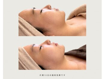サロンドシー(SALON DE C)の写真/韓国最新オンダリフト導入！結果重視サロンの即効性◎小顔メニュー！【全顔】