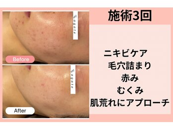 アガットバイミヤモト(agate by miyamoto)