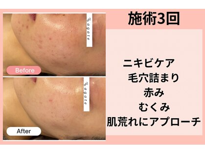 アガットバイミヤモト(agate by miyamoto)の写真