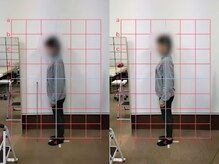 すずらん整体院の雰囲気(before→after【1回でこの効果◎】)