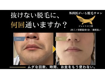 ジェントル 三宮の写真/【完全都度払い】国家資格保有者がいる脱毛サロン☆最適な出力設定でスピーディーに脱毛を♪